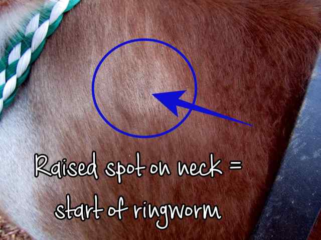 1 ringworm on neck